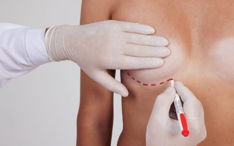 Cómo recuperar la firmeza de los senos después del embarazo sin cicatrices